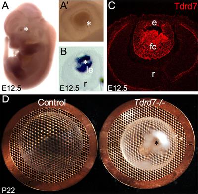 Genome-Wide Analysis of Differentially Expressed miRNAs and Their Associated Regulatory Networks in Lenses Deficient for the Congenital Cataract-Linked Tudor Domain Containing Protein TDRD7